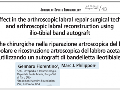 Mia pubblicazione su primo trapianto in Italia di labbro acetabolarie di anca in artroscopia 